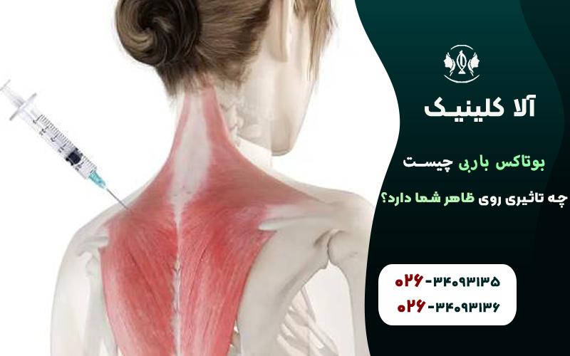 بوتاکس باربی چیست؟ چه تاثیری روی ظاهر شما دارد