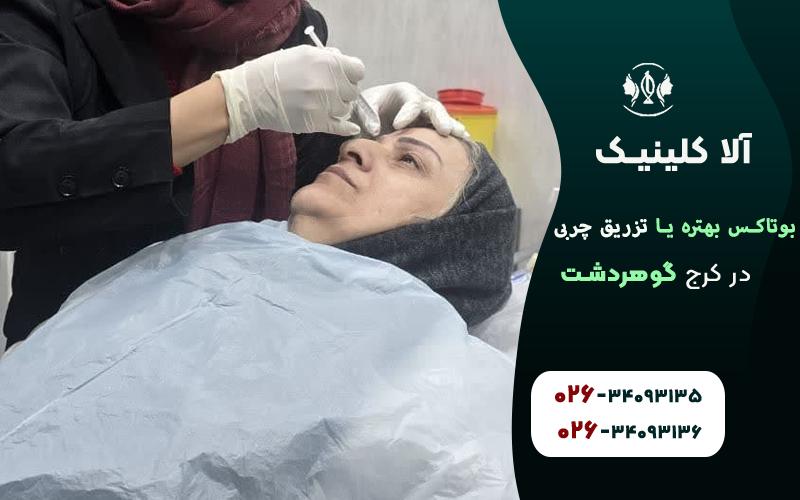 مقایسه تزریق بوتاکس و تزریق چربی کدام بهتر است