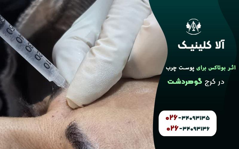 ایا بوتاکس بر پوست چرب اثر دارد