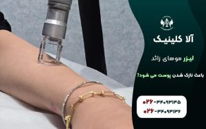 لیزر موهای زائد باعث نازک شدن پوست می شود