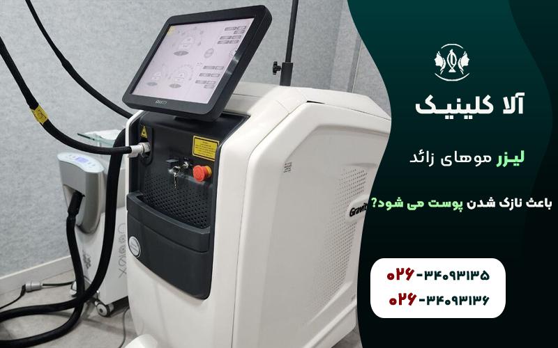 لیزر موهای زائد باعث نازک شدن پوست می شود