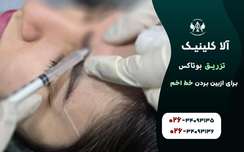 بوتاکس برای ازبین بردن خط اخم