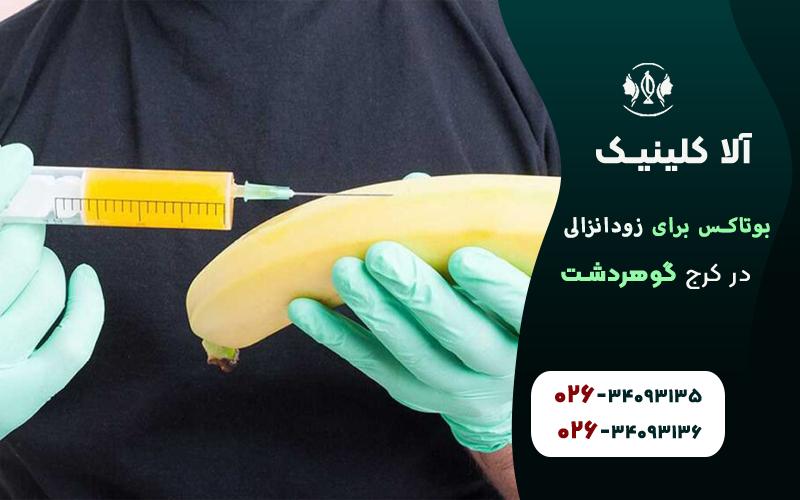نحوه تزریق بوتاکس برای درمان زود انزالی