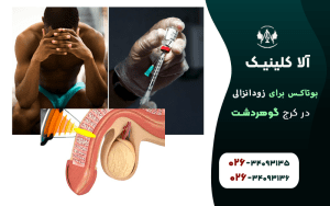 بوتاکس برای درمان زود انزالی
