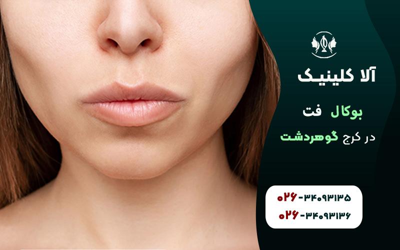 بوکال فت در کرج