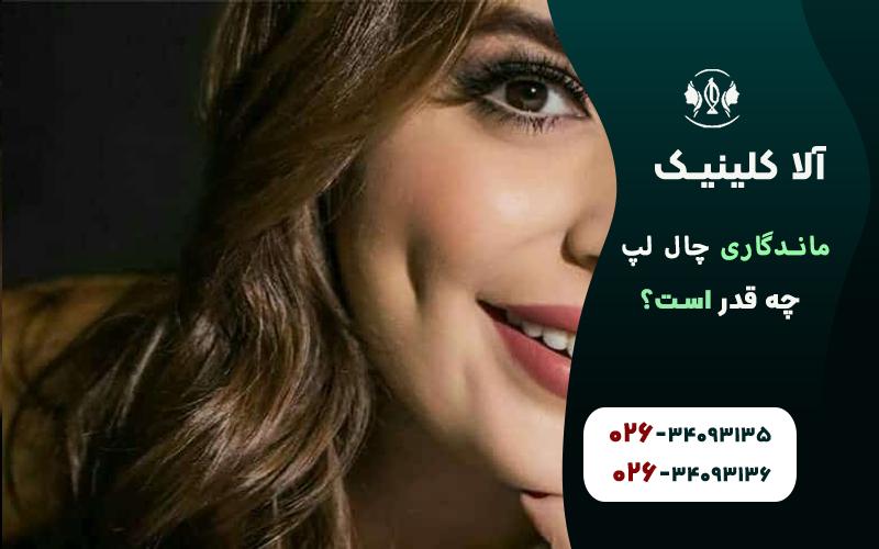 ماندگاری چال لپ چقدر است