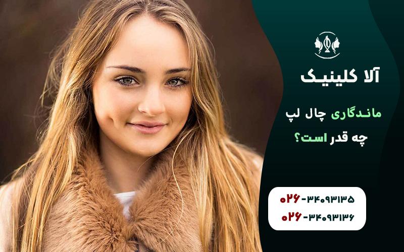 ماندگاری چال لپ چقدر است