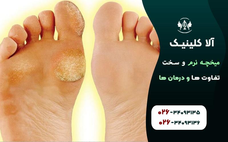پینه چیست