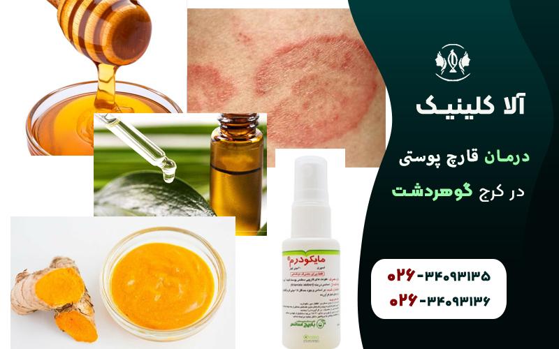درمان قارچ پوستی در کرج