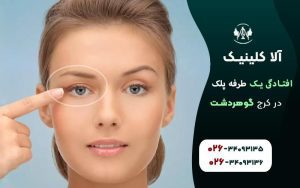 افتادگی یک طرفه پلک