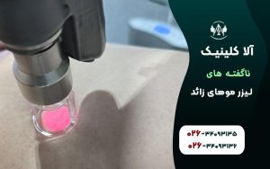 ناگفته های لیزر موهای زائد