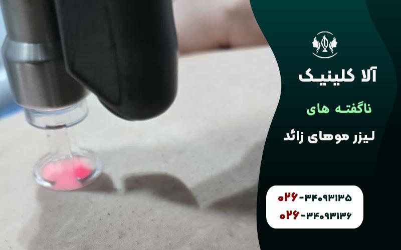 ناگفته های لیزر موهای زائد