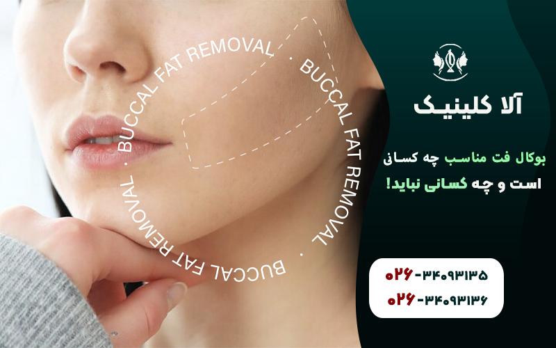 پد چربی بوکال چیست و چه نقشی دارد