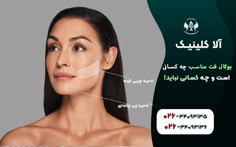 بوکال فت دقیقا مناسب چه کسانی است و چه کسانی نباید