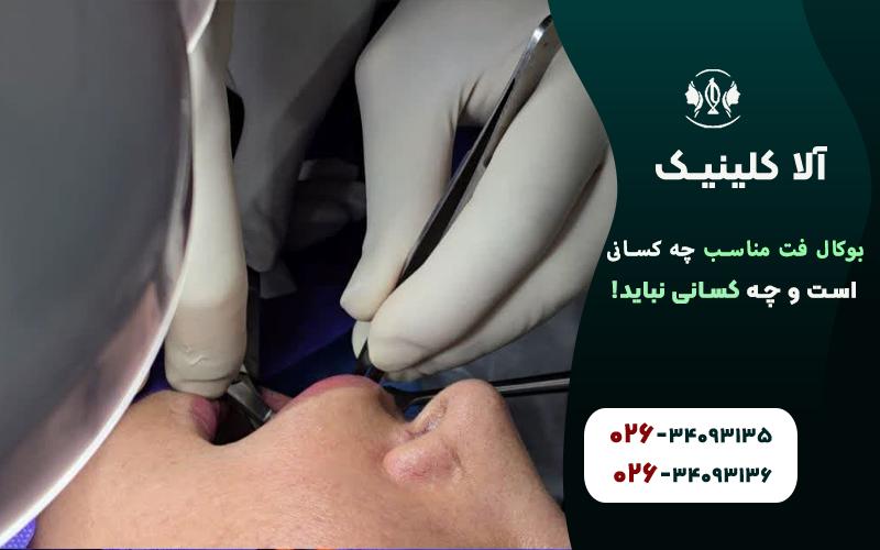 بوکال فت دقیقا مناسب چه کسانی است و چه کسانی نباید
