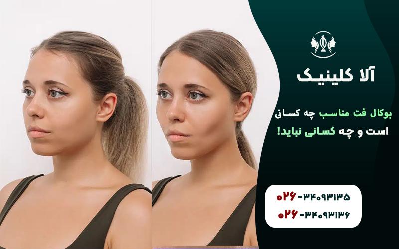 بوکال فت قبل و بعد