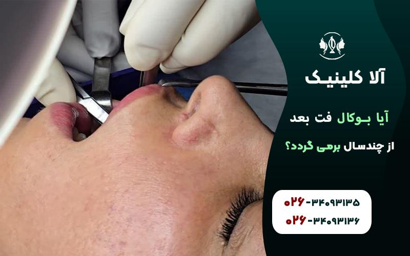 بررسی نتایج بوکال فت