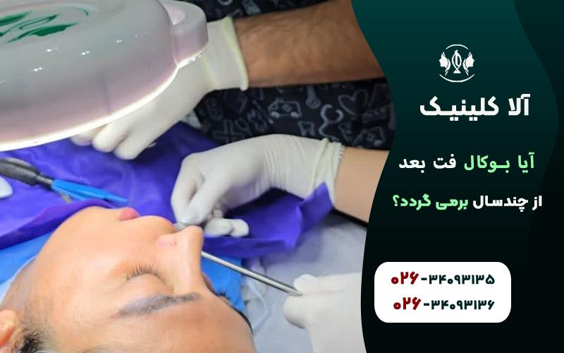 آیا بوکال فت پس از چند سال بر می گردد