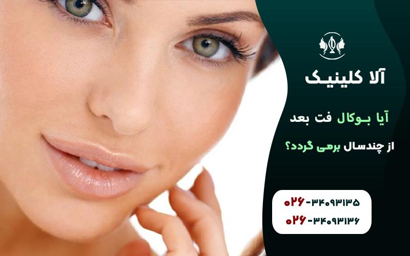 آیا بوکال فت پس از چند سال بر می گردد