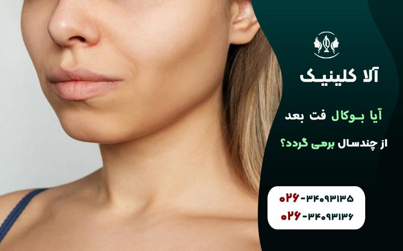 آیا بوکال فت پس از چند سال بر می گردد