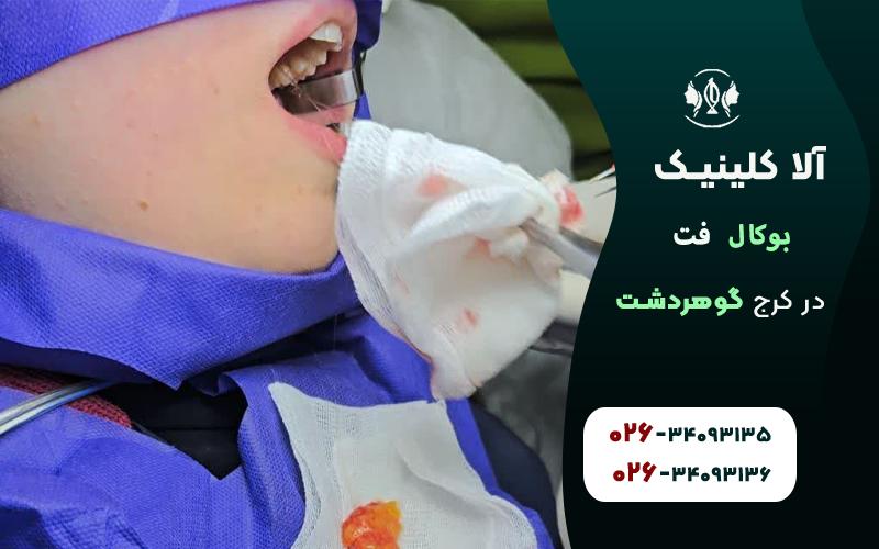 جراحی بوکال فت در کرج