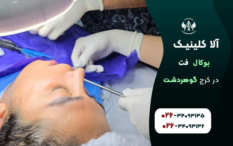 عمل بوکال فت در کلینیک آلا