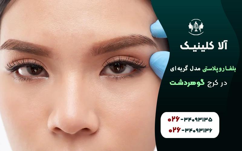عمل بلفاروپلاستی مدل گربه ای در کرج