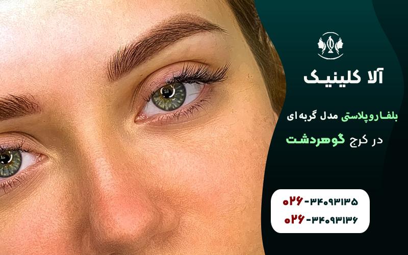 بلفاروپلاستی مدل گربه ای در کرج