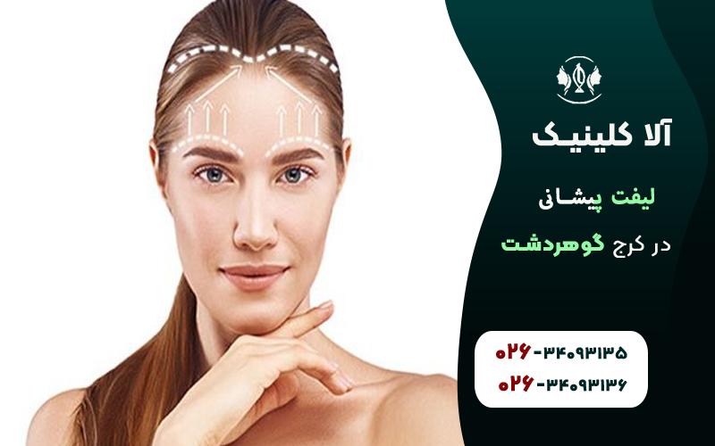  لیفت پیشانی در کرج 