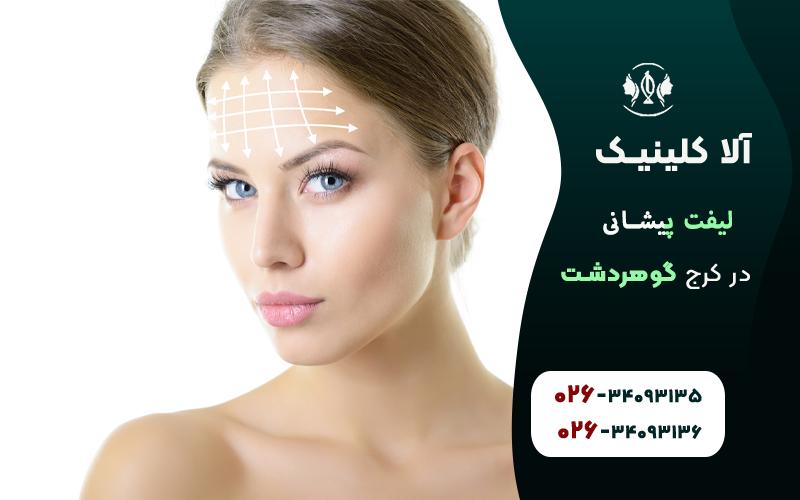  لیفت پیشانی در کرج 