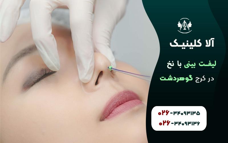 لیفت بینی با نخ