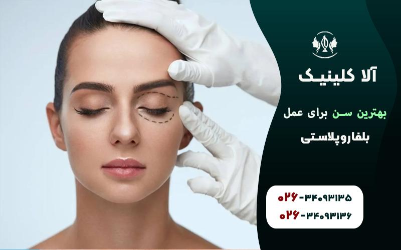 بهترین سن برای عمل بلفاروپلاستی