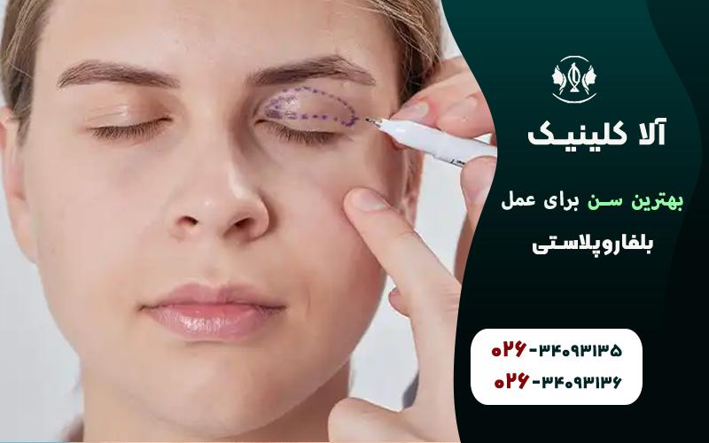 بهترین سن برای عمل بلفاروپلاستی