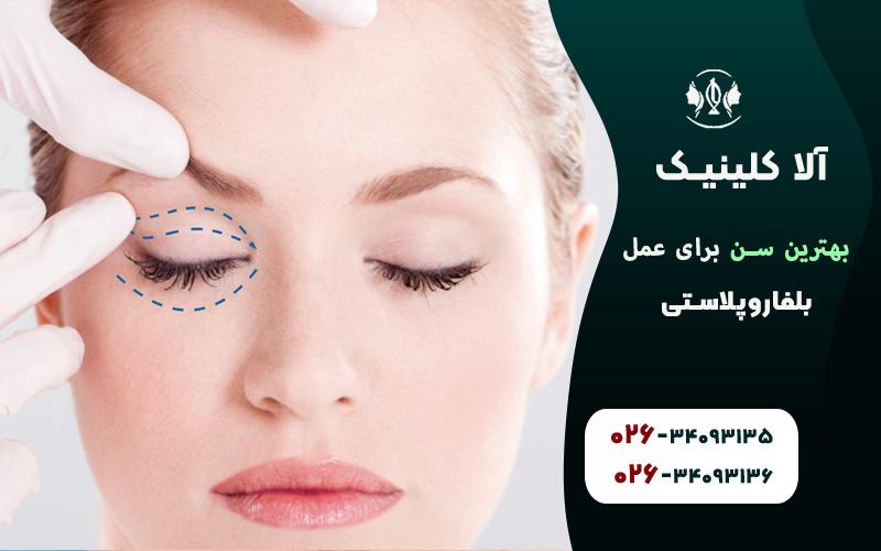 بهترین سن برای عمل بلفاروپلاستی چه سنی است