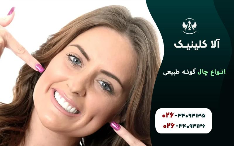 چال گونه متناسب با لبخند