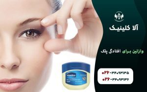 وازلین برای افتادگی پلک : آیا کار می‌کند
