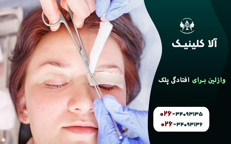 رفع افتادگی پلک با عمل بلفا