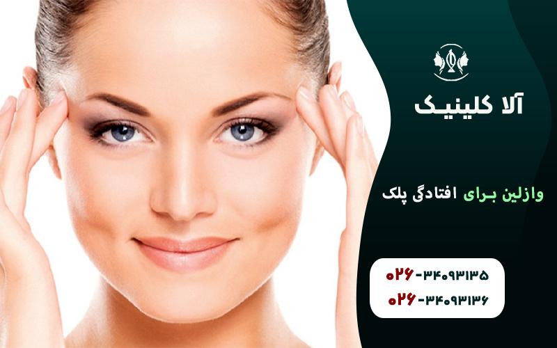 چگونه وازلین ممکن است به طور غیرمستقیم (و موقت) تأثیر بگذارد