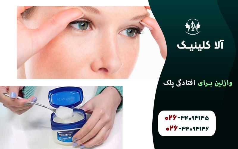 وازلین برای افتادگی پلک