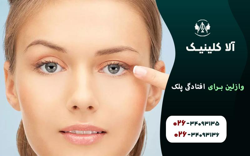 وازلین برای افتادگی پلک : آیا کار می‌کند