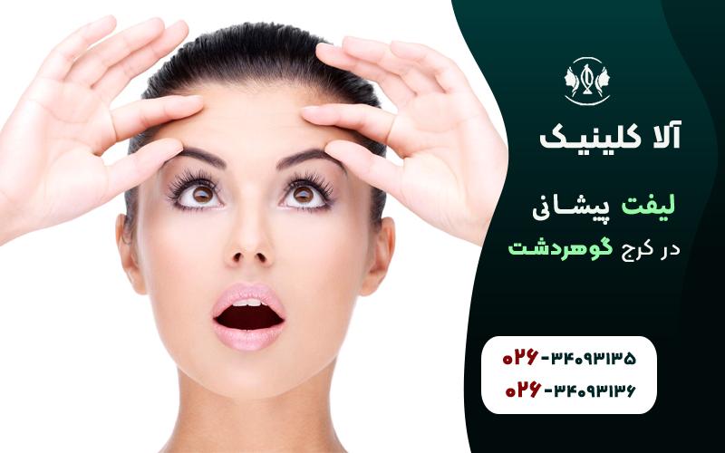 لیفت پیشانی