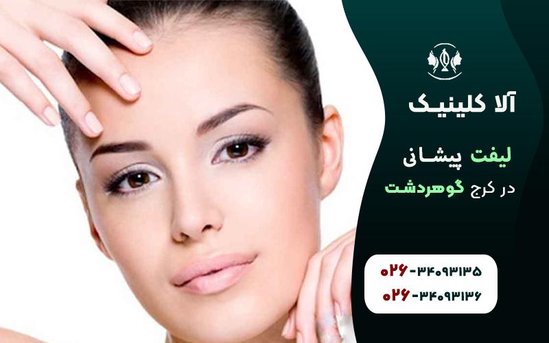 لیفت پیشانی در کرج