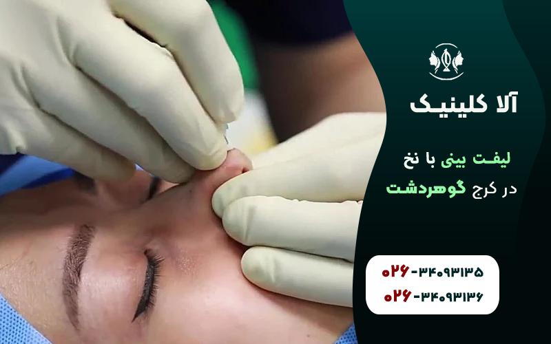 نحوه انجام لیفت بینی با نخ