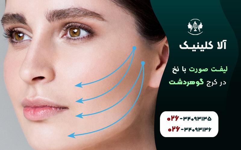 مزایای لیفت صورت با نخ