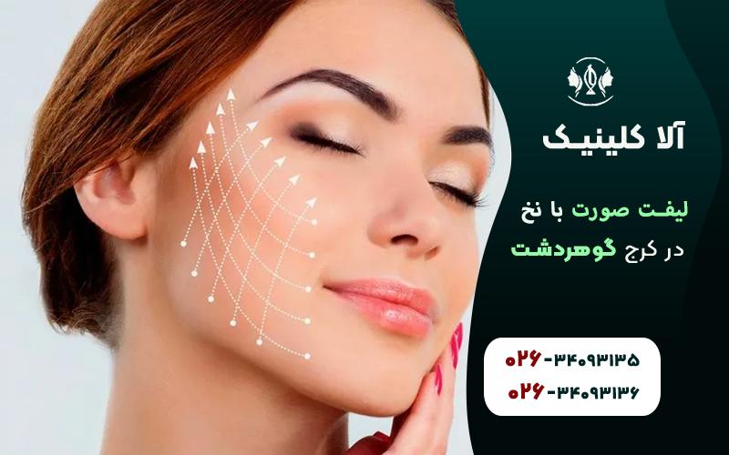 روش های لیفت صورت با نخ در کرج