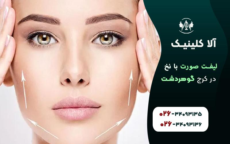 کاندیدای لیفت صورت با نخ