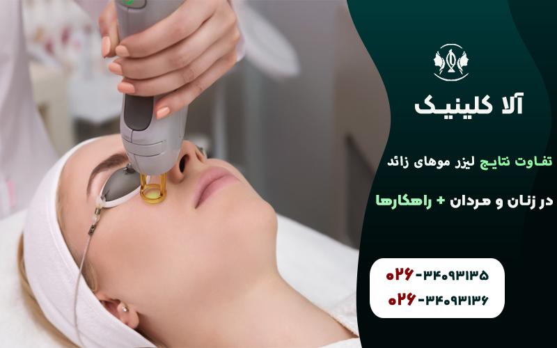 تفاوت نتایج لیزر موهای زائد در زنان و مردان