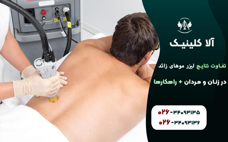 تاثیر جلسات لیزر روی موی زائد زنان و مردان