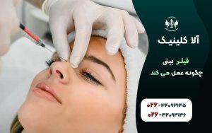 فیلر بینی چگونه عمل می کند؟ همه چیز درباره روند تزریق