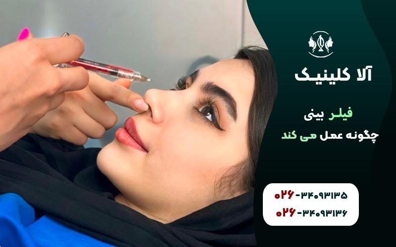 همه چیز درباره روند تزریق